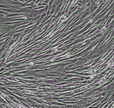 Cell preparation for treating osteoarthritis and preparation method thereof