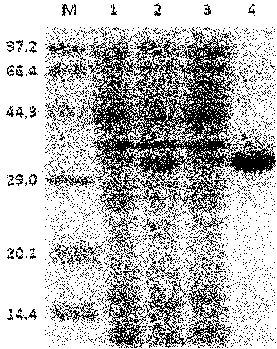 Human anionic trypsin mutant