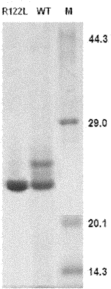 Human anionic trypsin mutant