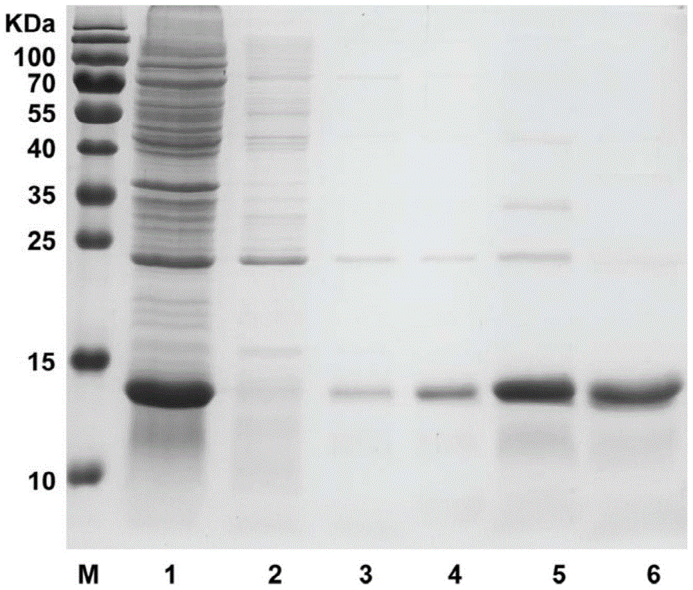 Preparation of monoclonal antibody 7H8 capable of resisting epitope at N terminal of human procalcitonin protein