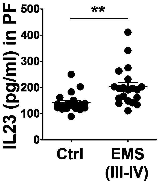 Application of interleukin-23 neutralizing antibody in preparation of endometriosis medicine