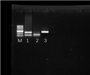 Primer and kit for using RPA for detecting procambarus clarki picornaviridae and detection method