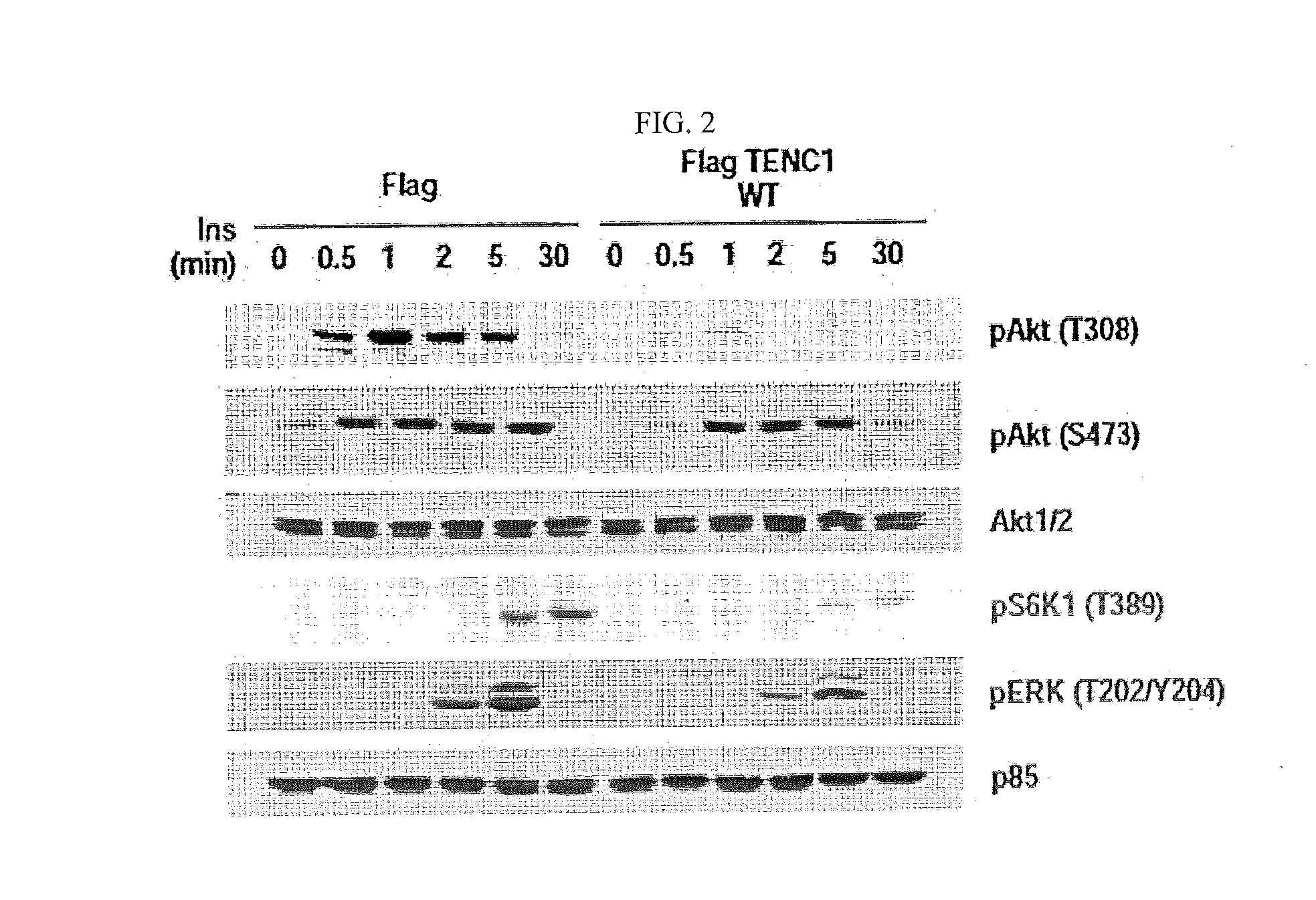 Pharmaceutical Composition for Preventing or Treating Diabetes Containing TENC1 Expression or Activity Suppressor