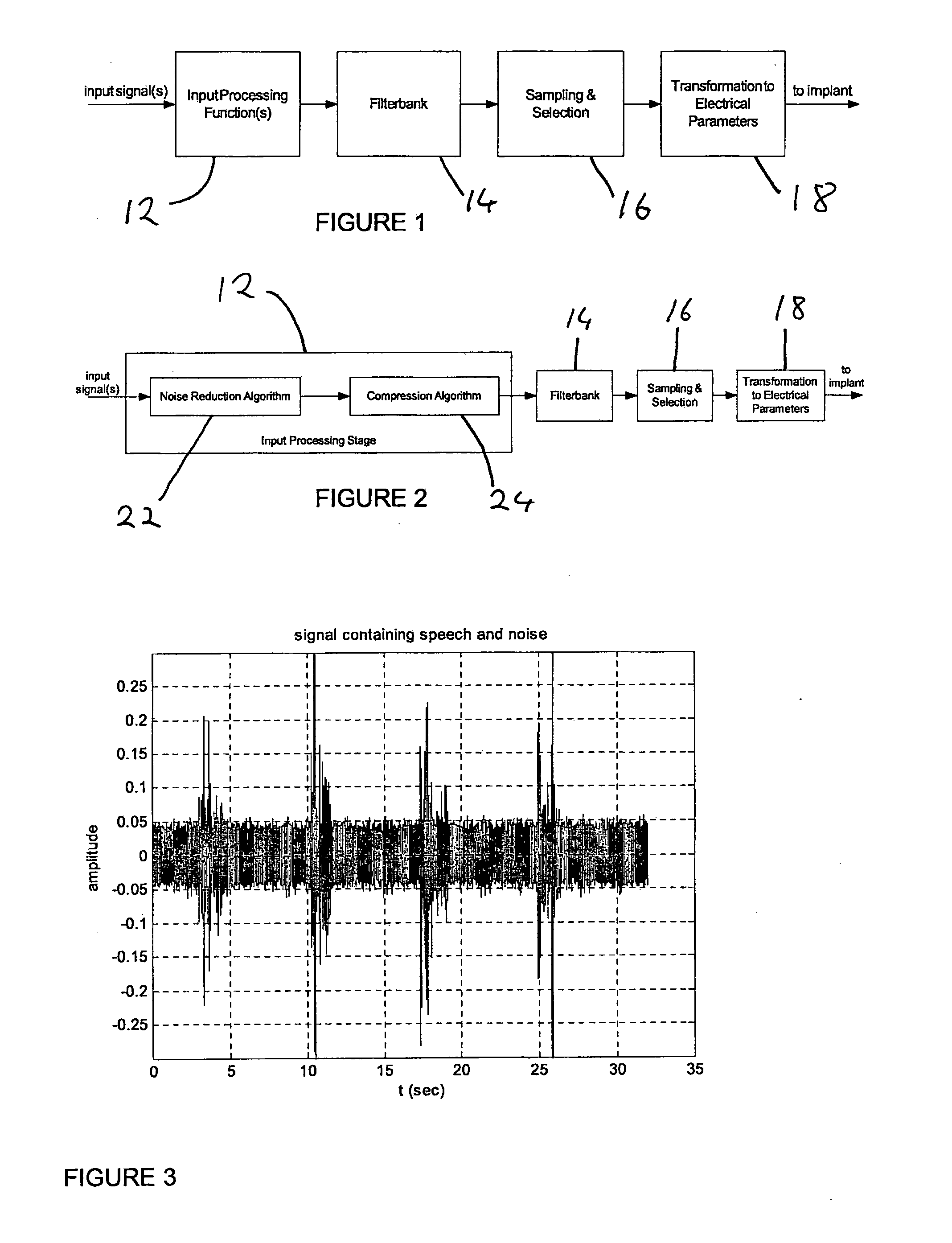 Noise reduction in auditory prostheses