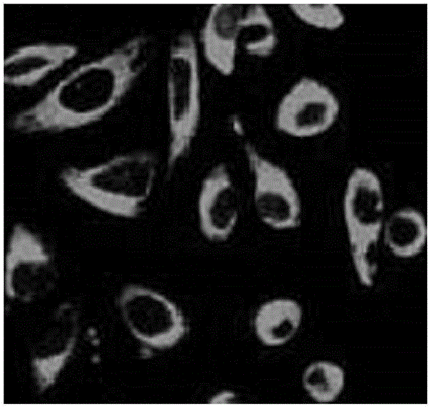 Composite nano-grade novel material based on cancer early-stage integrated detection, diagnoses, and treatment, and preparation method thereof