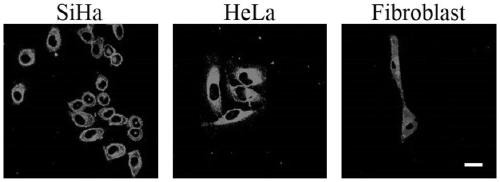 Fluorescent probe for displaying two states of cell membrane potential by using fluorescence image and application thereof