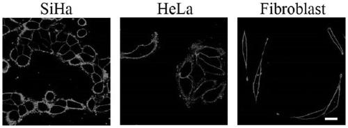 Fluorescent probe for displaying two states of cell membrane potential by using fluorescence image and application thereof