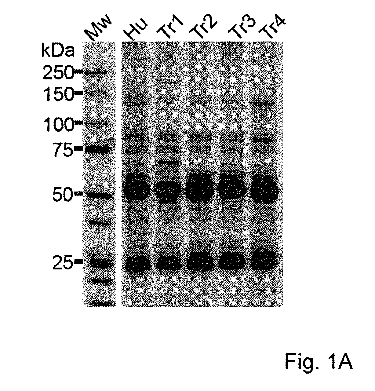 Assay for anti-TR antibodies