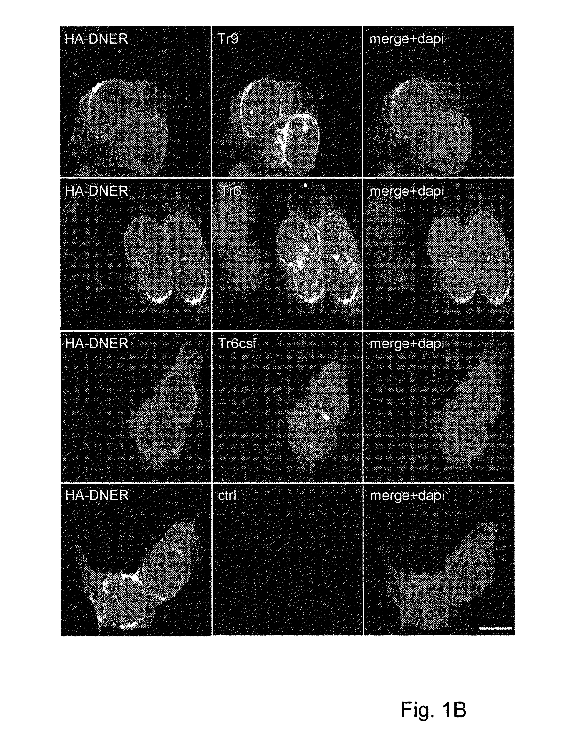 Assay for anti-TR antibodies