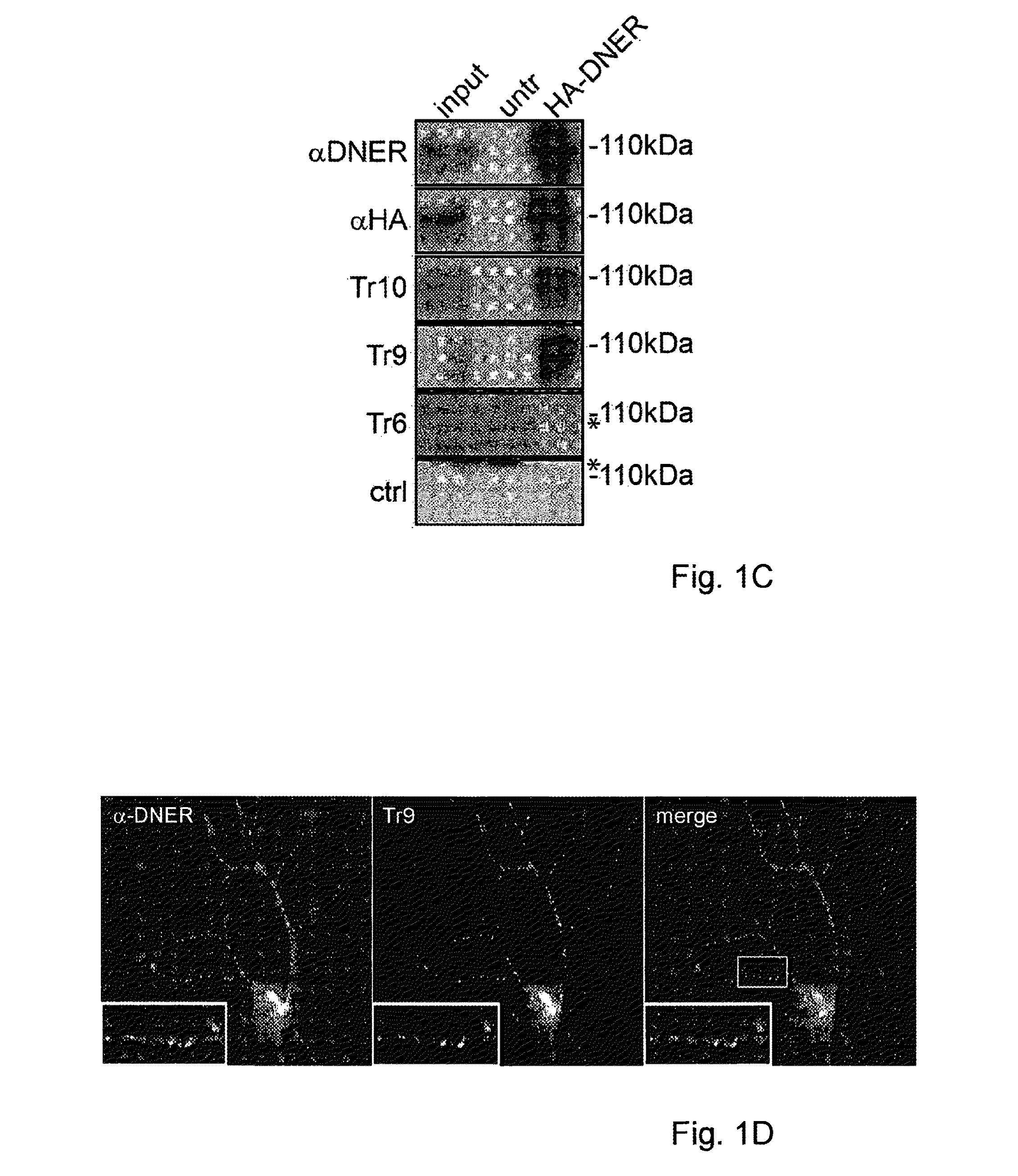 Assay for anti-TR antibodies