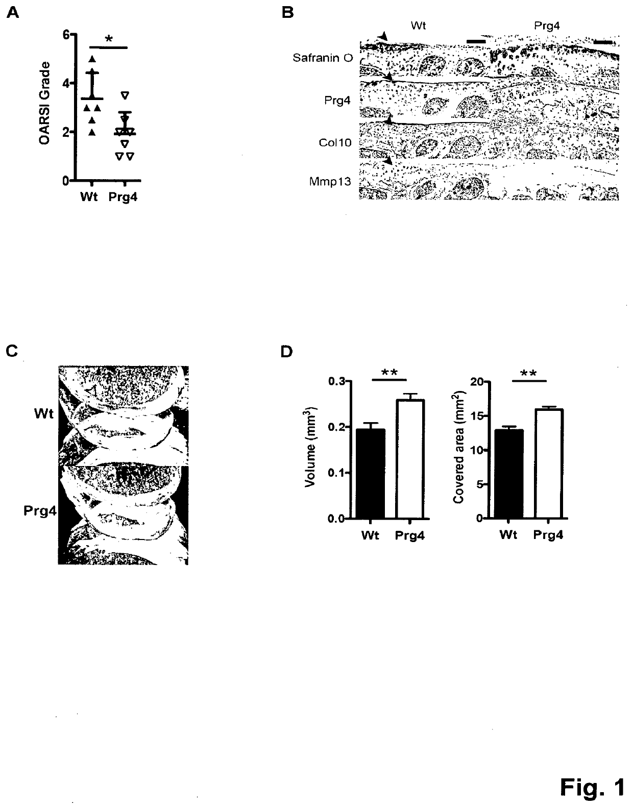 Helper-dependent adenoviral gene therapy delivery and expression system