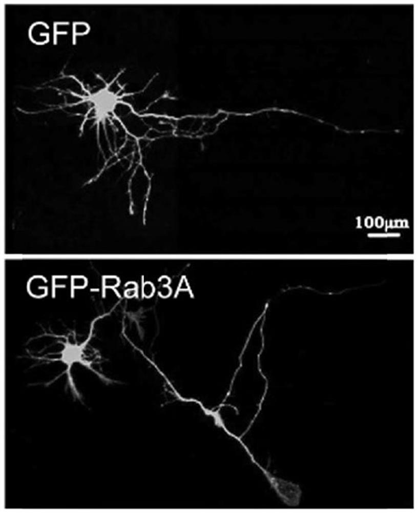 A kind of pharmaceutical composition for treating spinal cord injury and repairing and application thereof