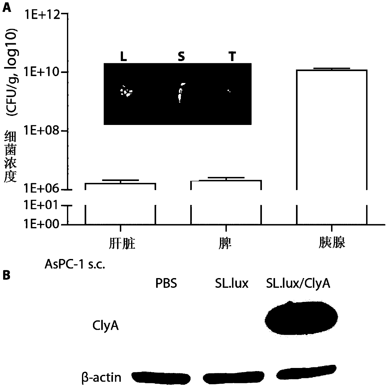 Attenuated recombinant bacterium, preparation method thereof, application, and tumor targeted medicine