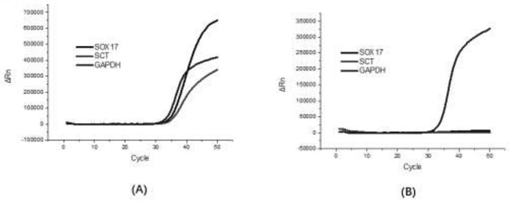 Plasma free DNA methylation gene combination for identifying benign and malignant pulmonary nodules, and application of plasma free DNA methylation gene combination