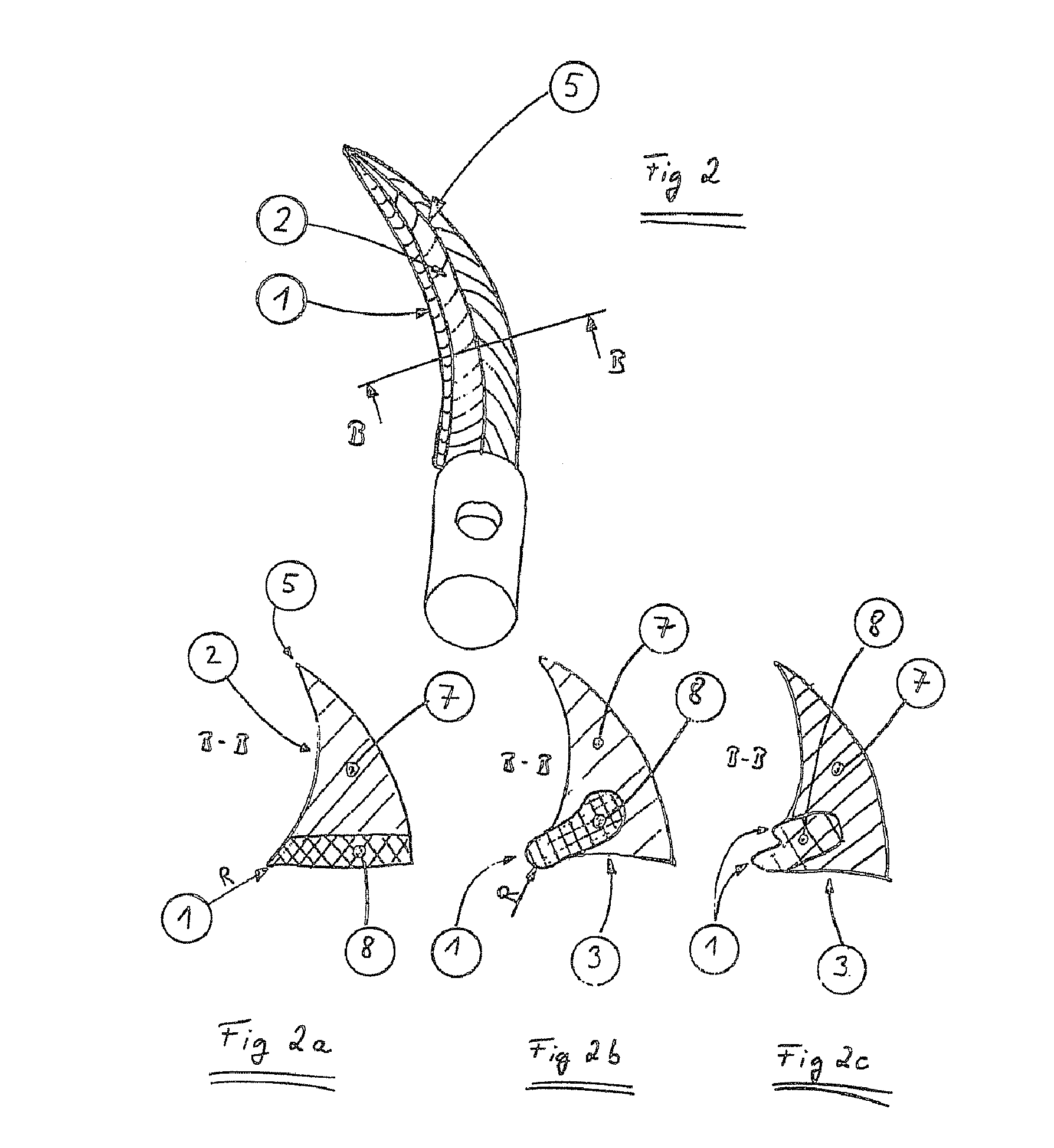 Interdental wedge