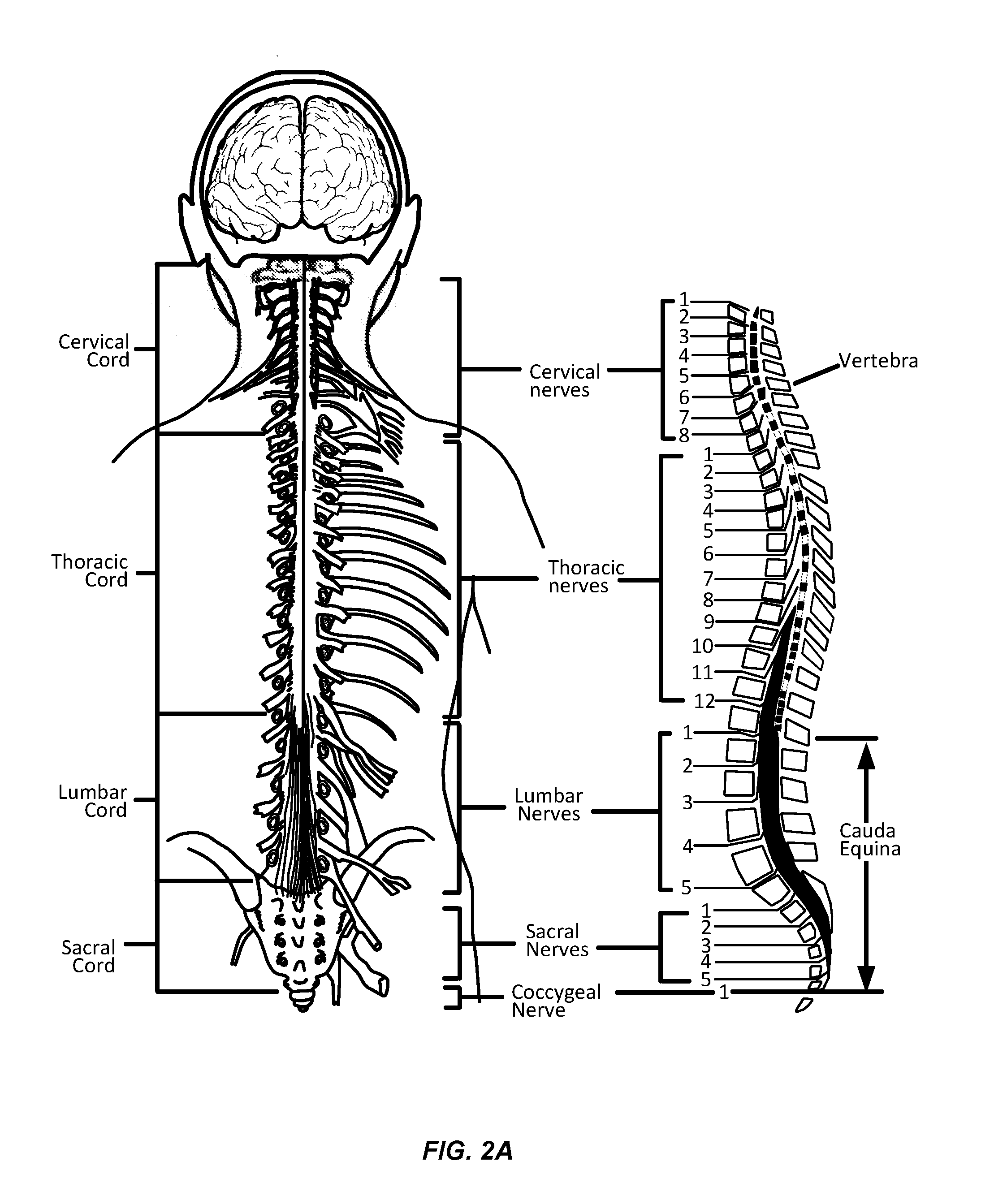 Implantable Lead Affixation Structure for Nerve Stimulation to Alleviate Bladder Dysfunction and Other Indication