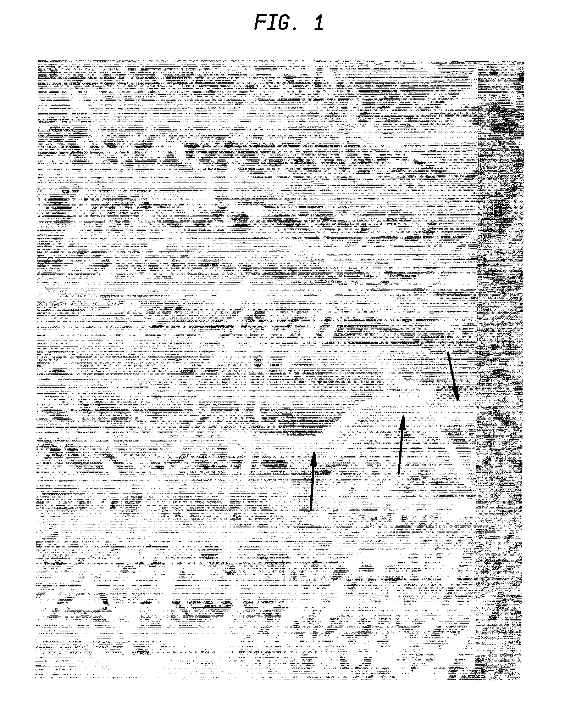 Extracellular matrix cancer vaccine adjuvant