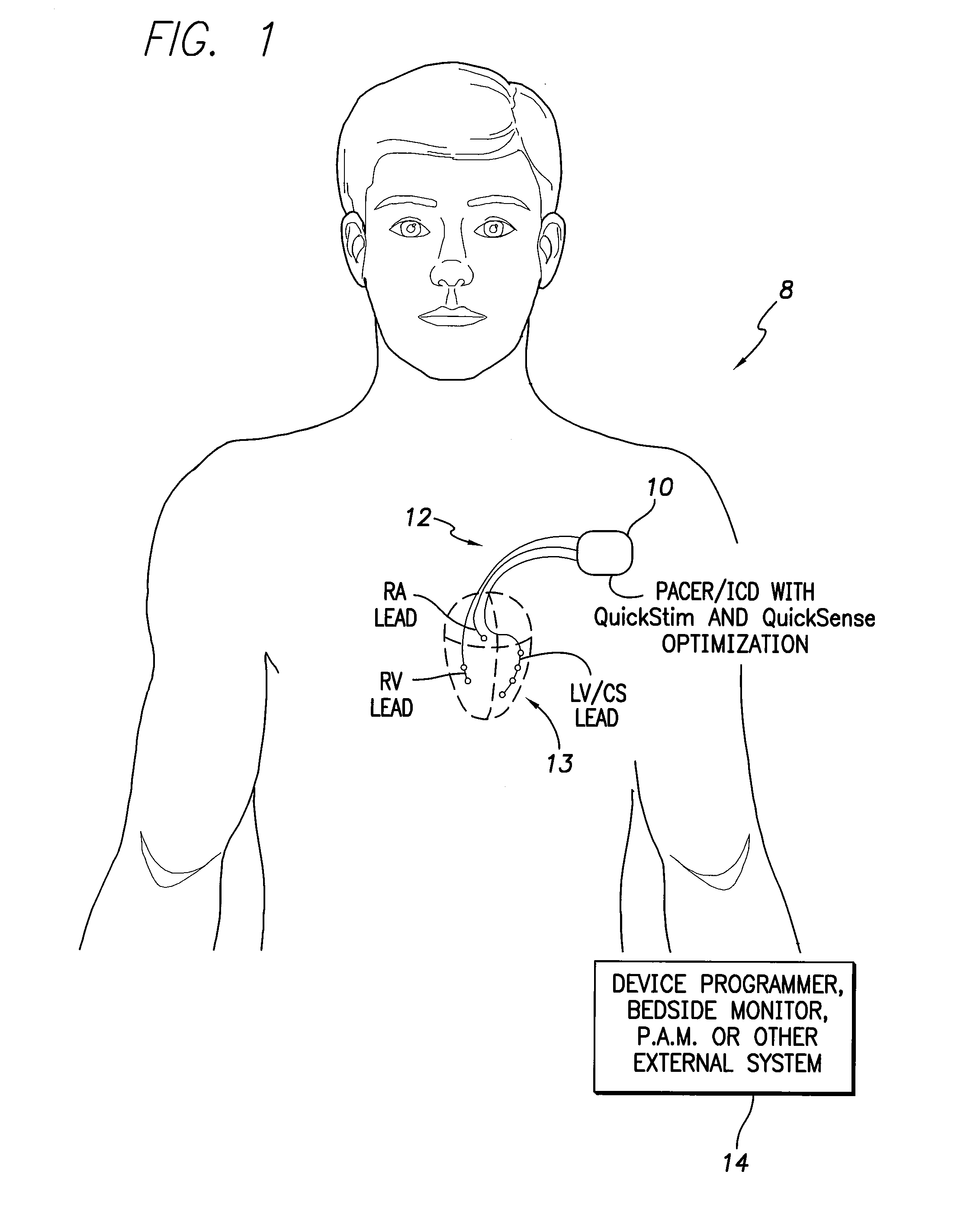 Systems and methods for optimizing multi-site cardiac pacing and sensing configurations for use with an implantable medical device