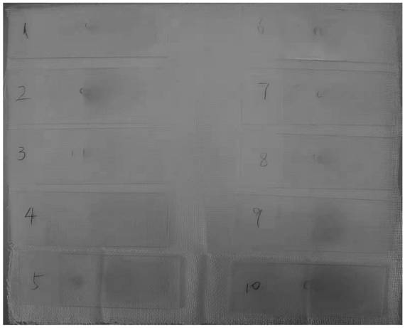 Treatment method of thick blood film of blood smear for plasmodium microscopic examination