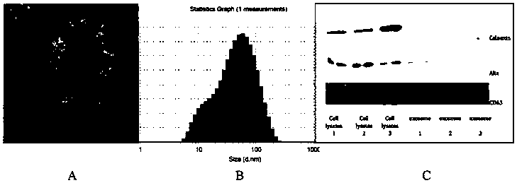 lncRNA LLNLR-299G3.1 related to esophageal squamous cell carcinoma (ESCC) and application thereof