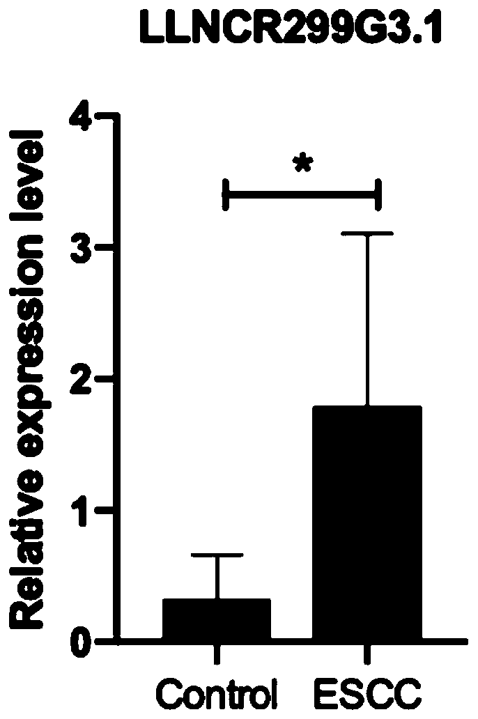 lncRNA LLNLR-299G3.1 related to esophageal squamous cell carcinoma (ESCC) and application thereof