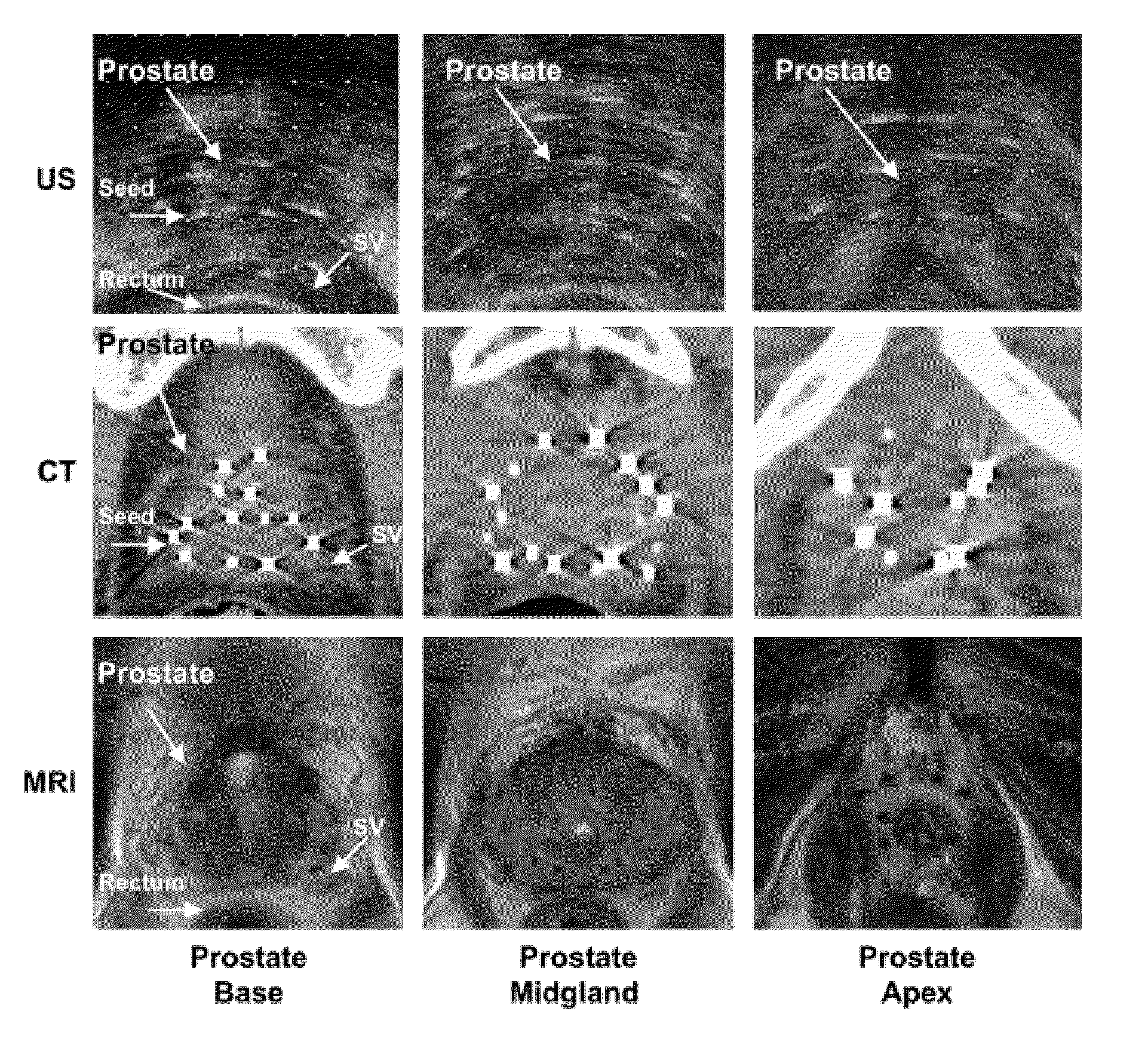 Seeds and Markers for Use in Imaging