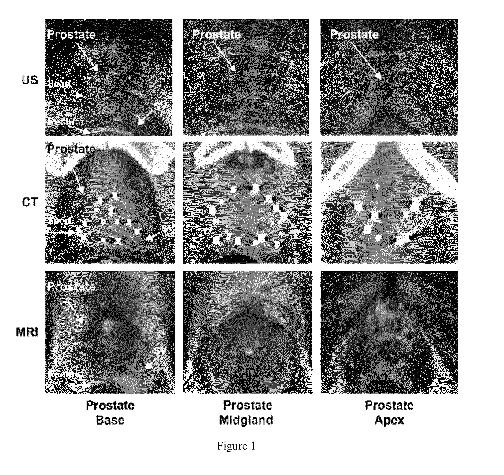 Seeds and Markers for Use in Imaging