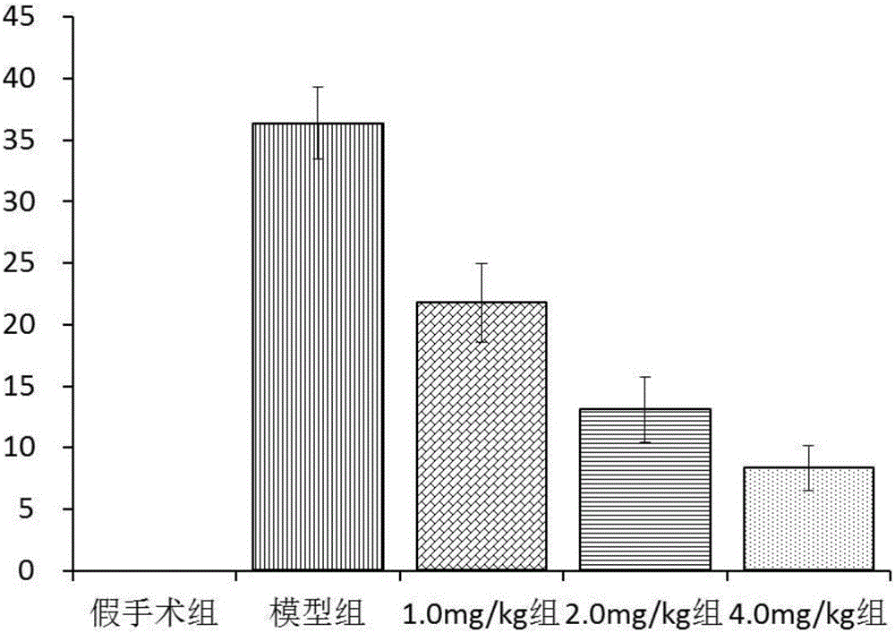 Application of polypeptide in medicines for preventing or treating myocardial ischemia-reperfusion injury related diseases