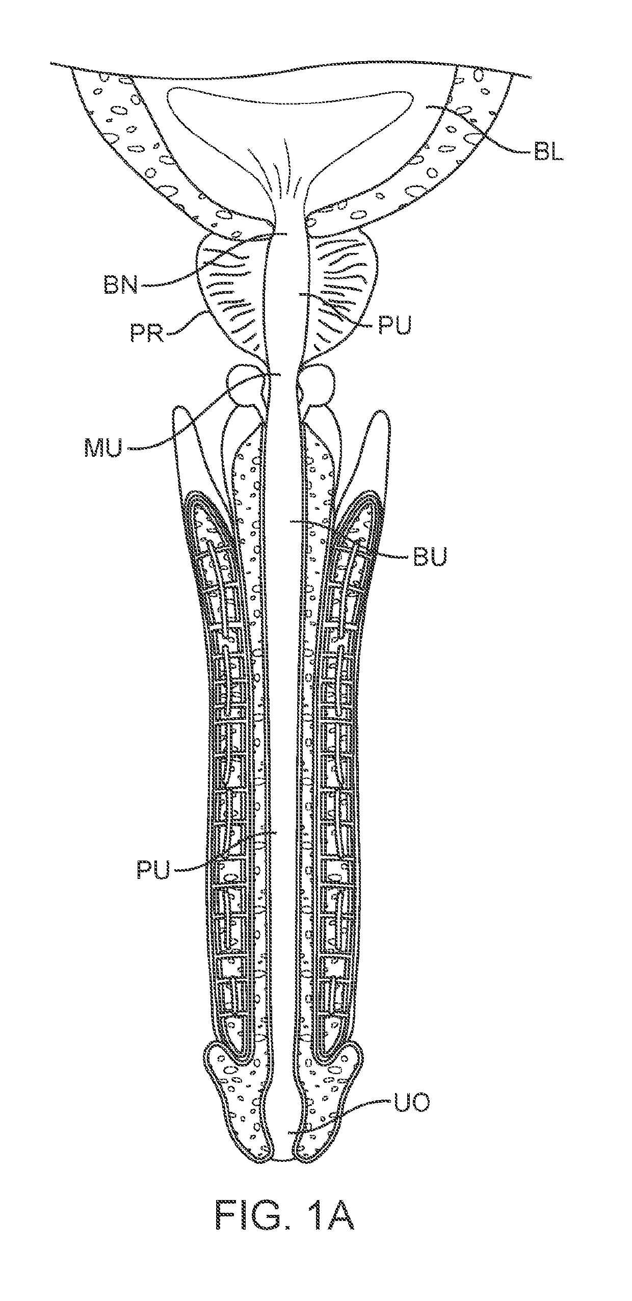 Indwelling body lumen expander