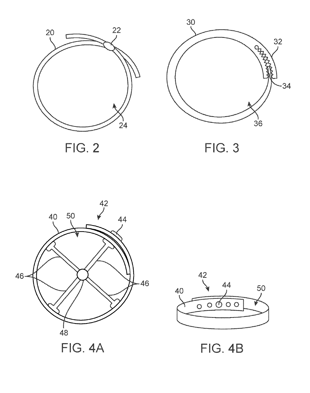 Indwelling body lumen expander