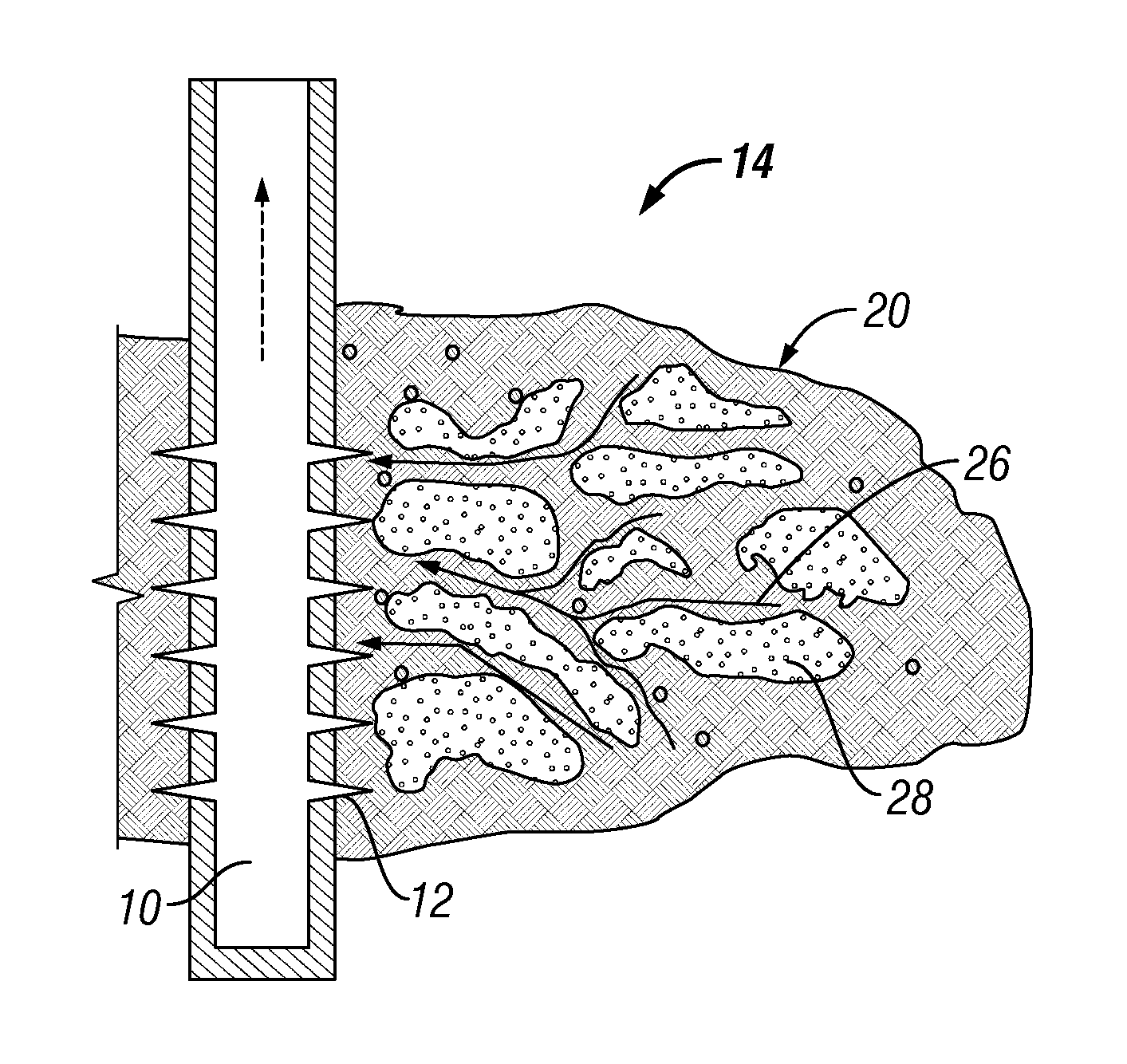 Heterogeneous proppant placement in a fracture with removable channelant fill