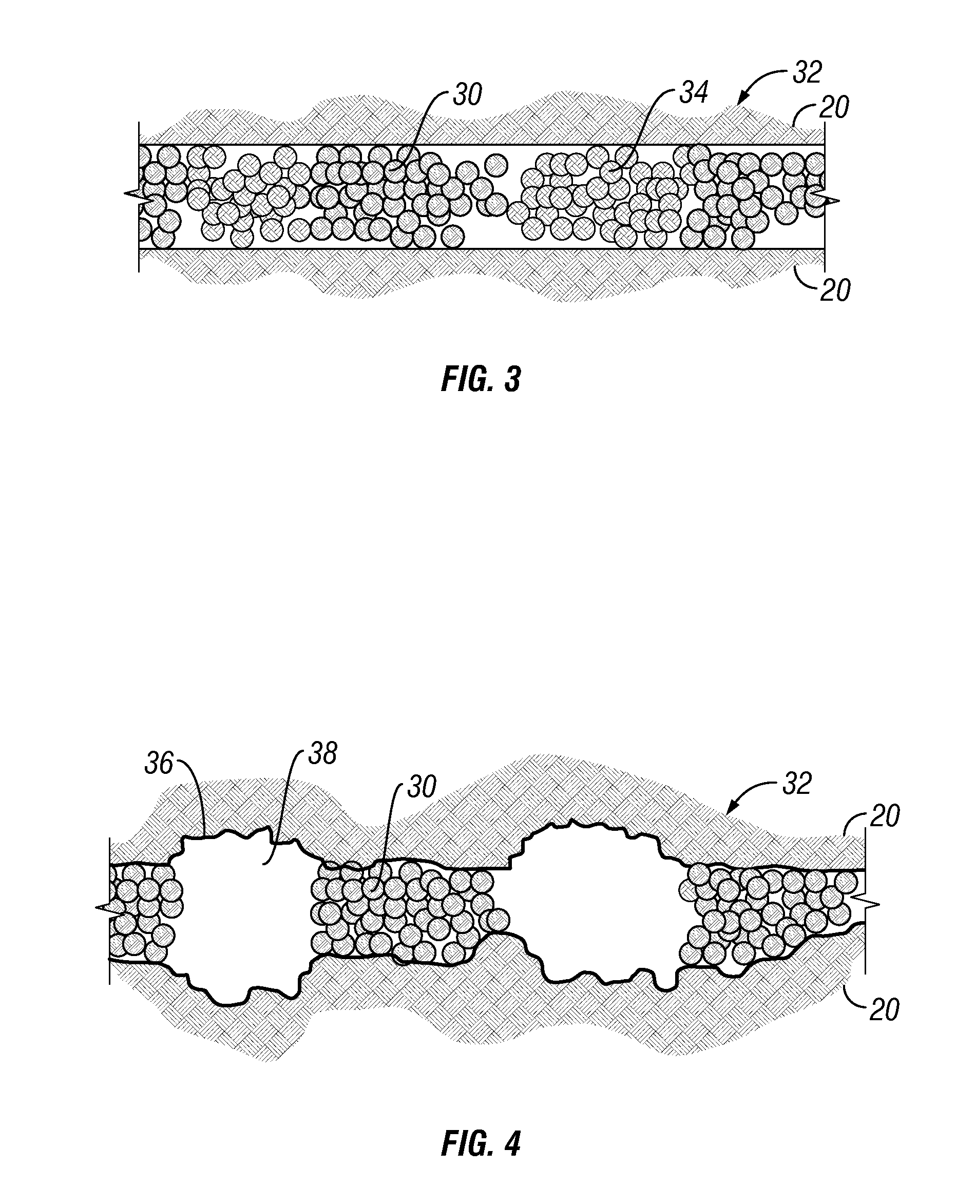 Heterogeneous proppant placement in a fracture with removable channelant fill