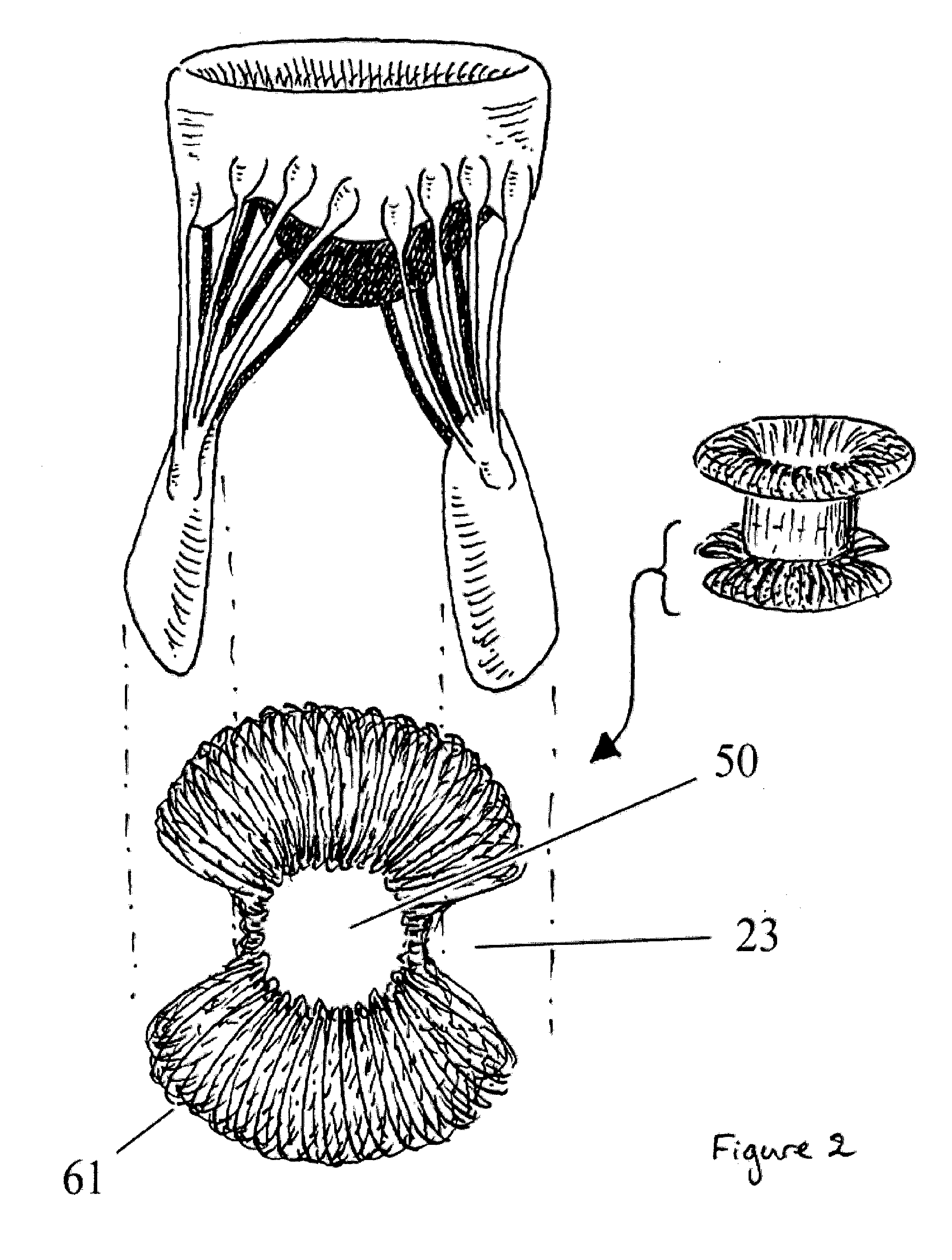 Disk-Based Valve Apparatus and Method for the Treatment of Valve Dysfunction