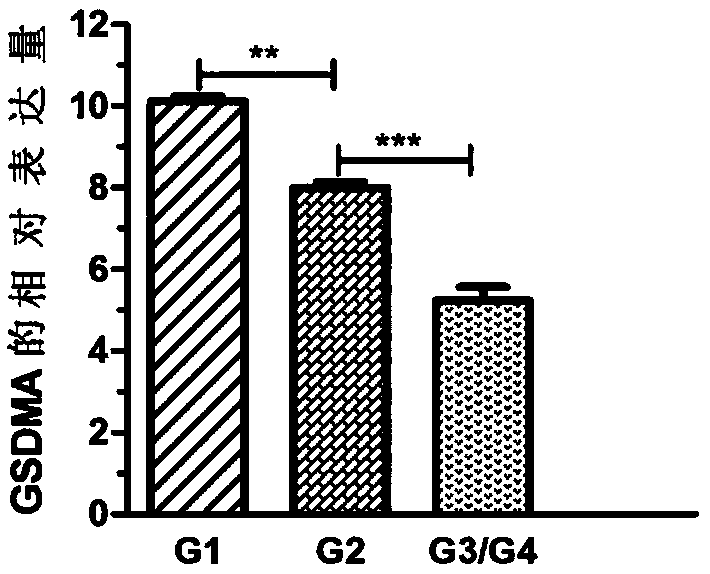 Application of biomarker to assessment of oral squamous cell carcinoma hazard levels