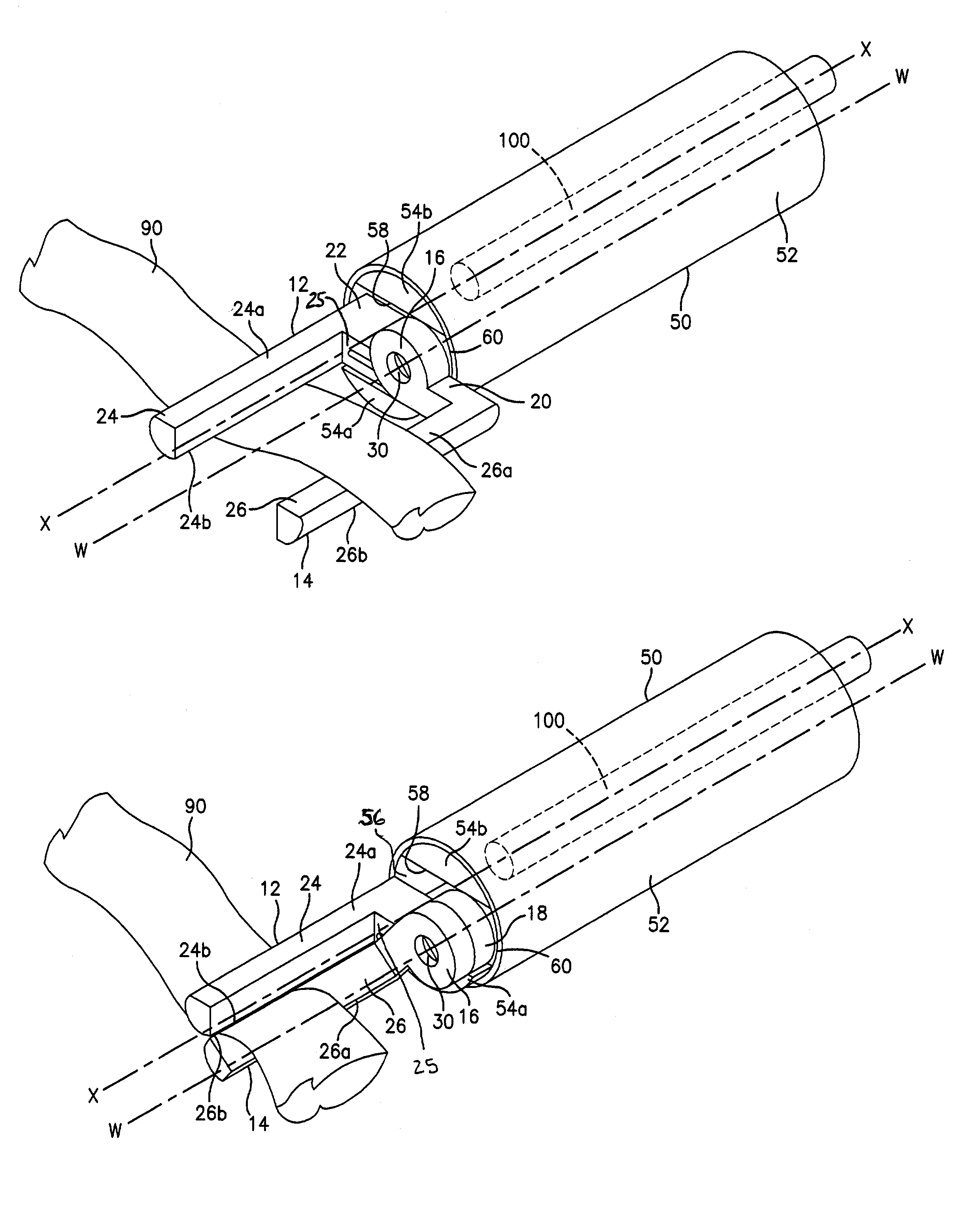 Ligation clip applier and method