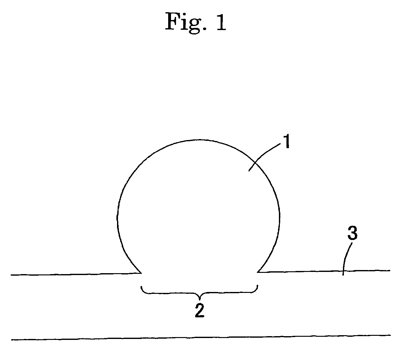 Embolization device for vessel cavity in vivo