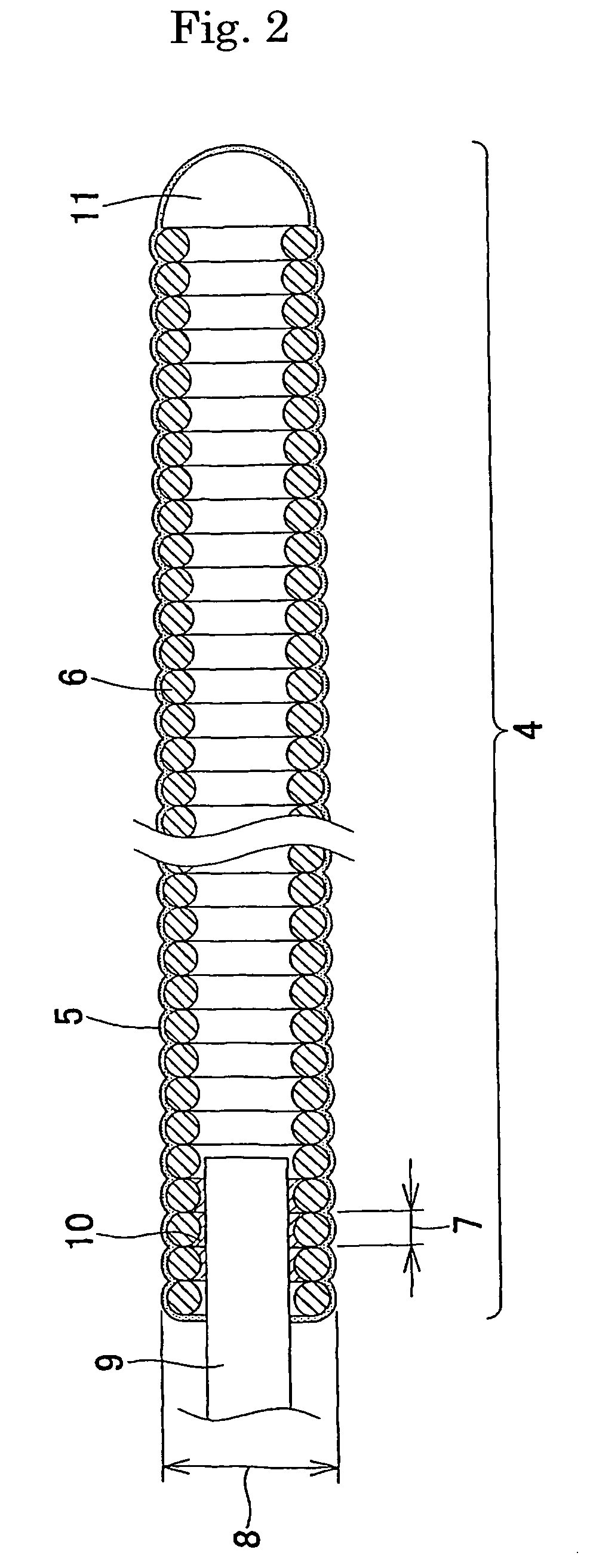 Embolization device for vessel cavity in vivo