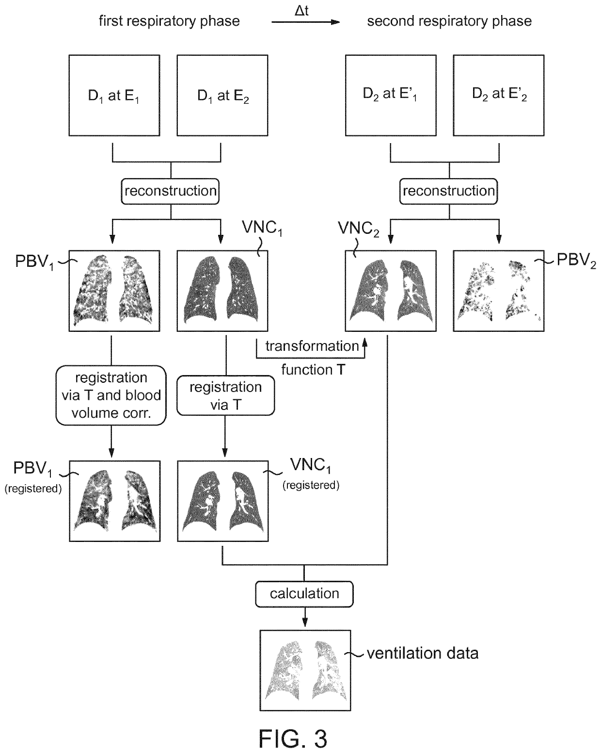 Method for processing computed tomography imaging data of a suspect's respiratory system