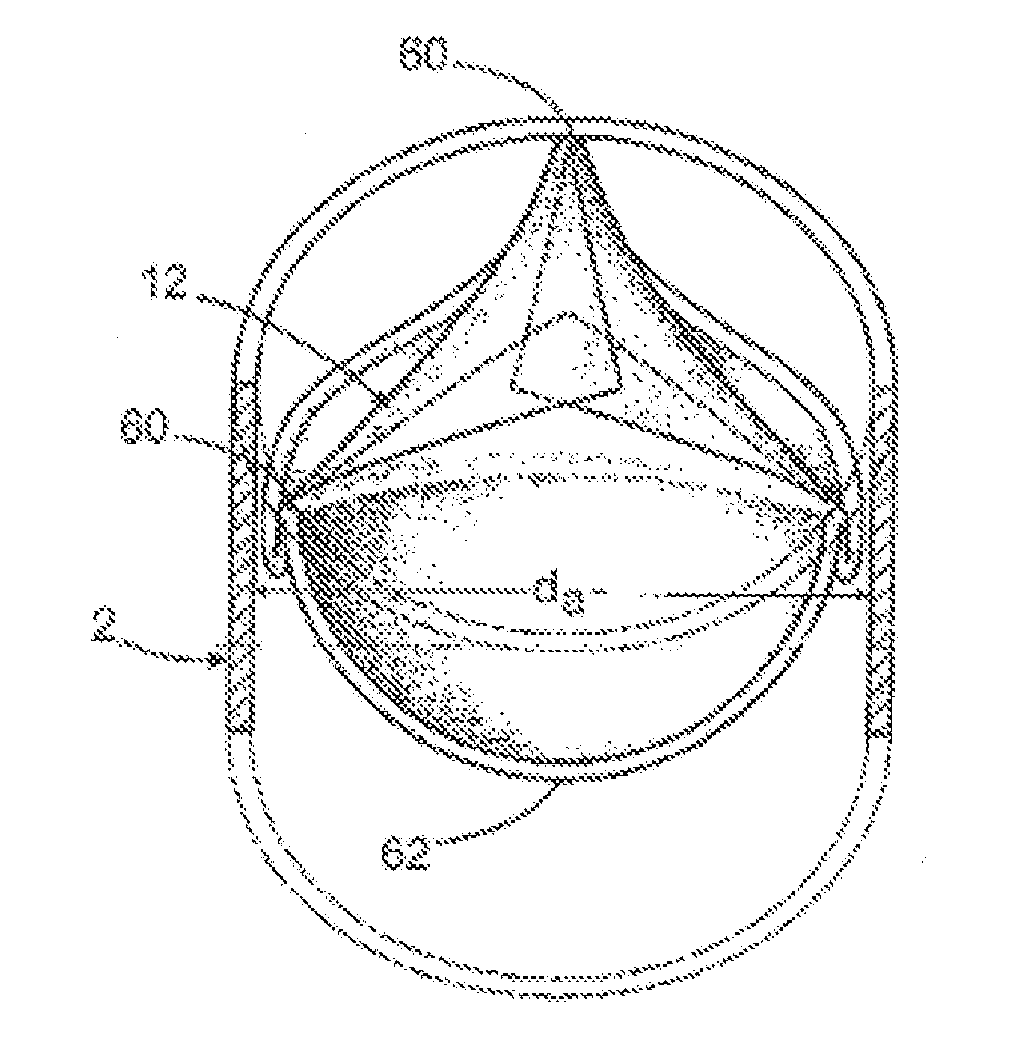 Prosthetic tissue valve