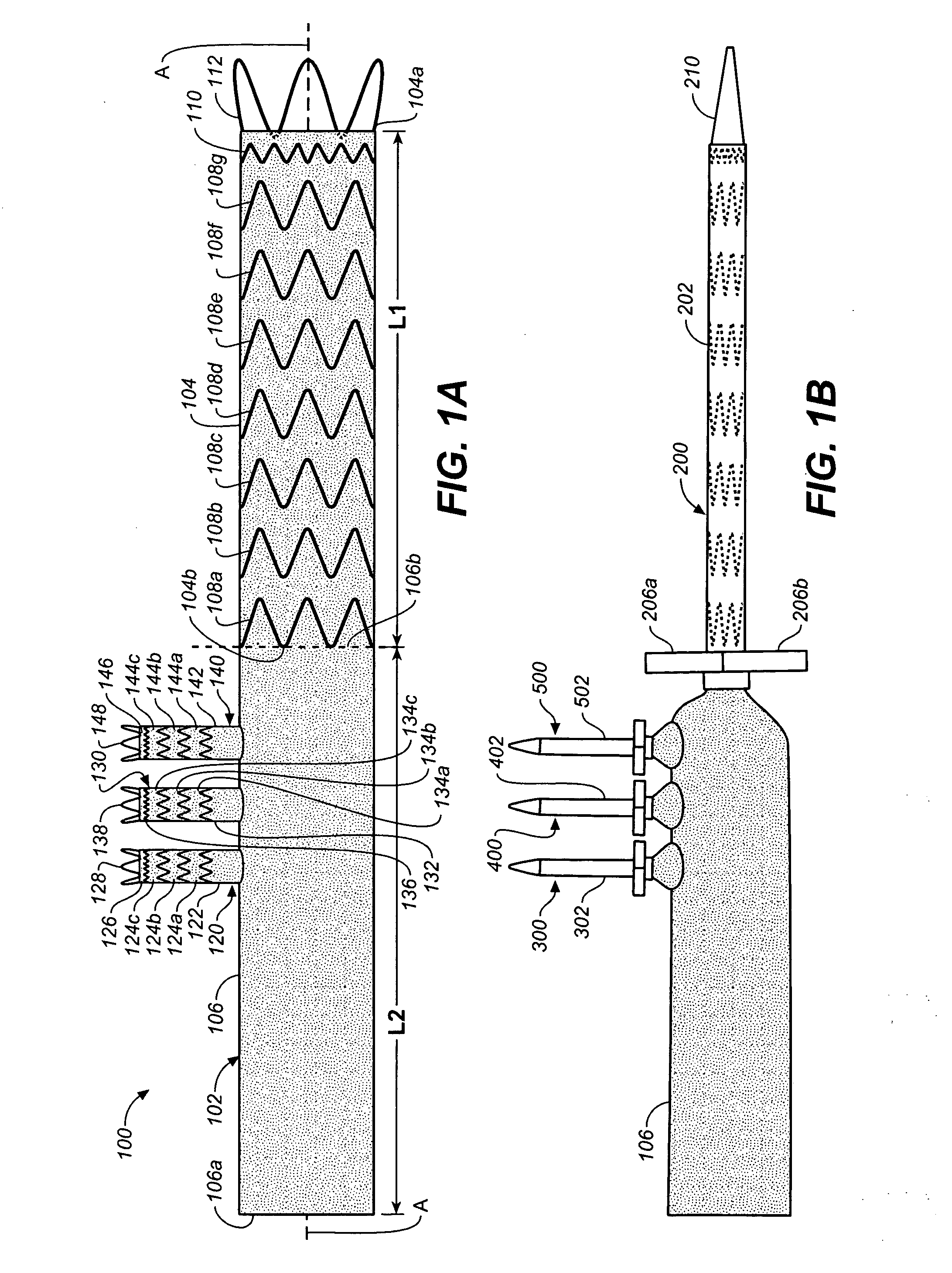 Prosthesis for Antegrade Deployment