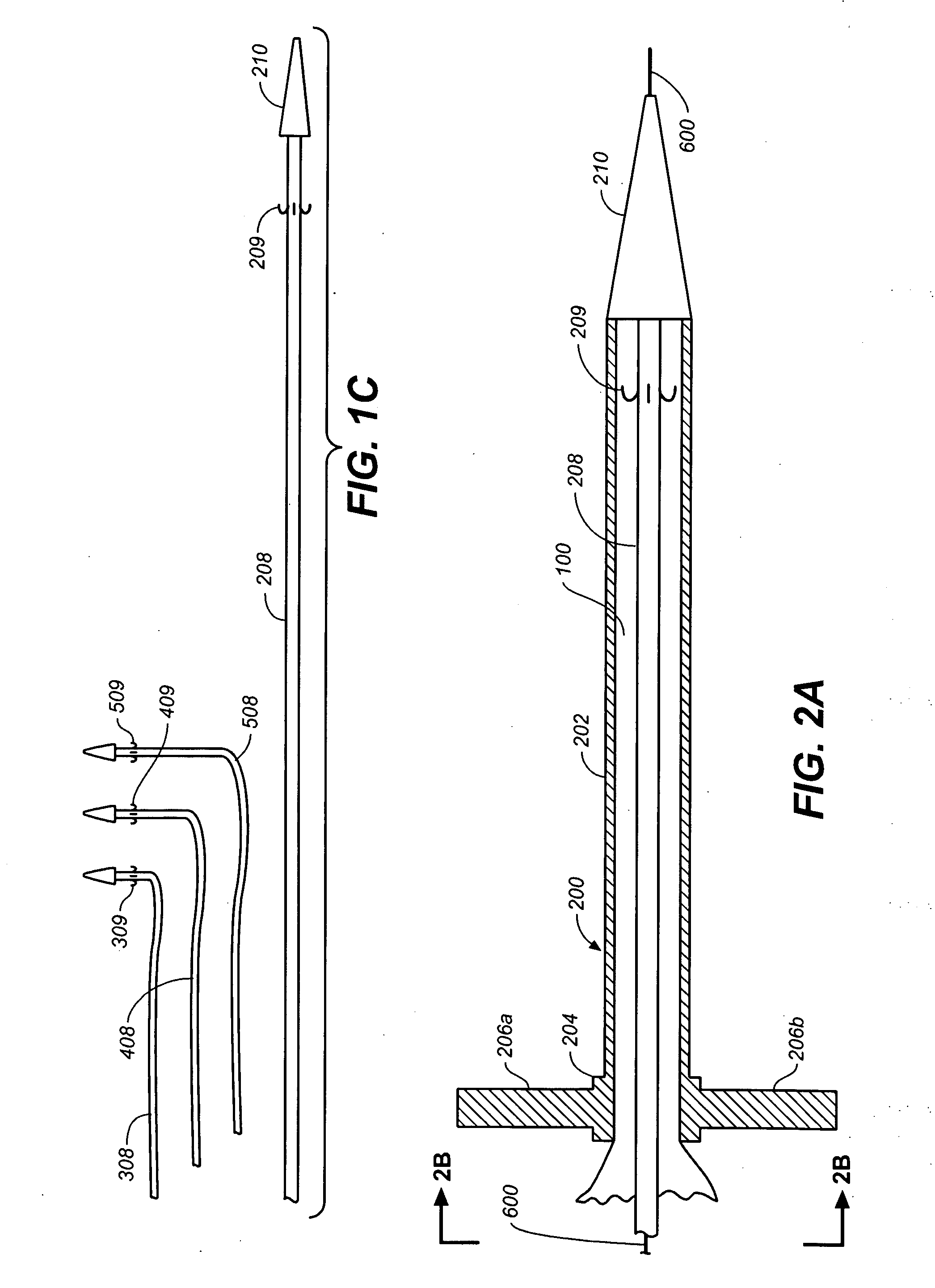 Prosthesis for Antegrade Deployment