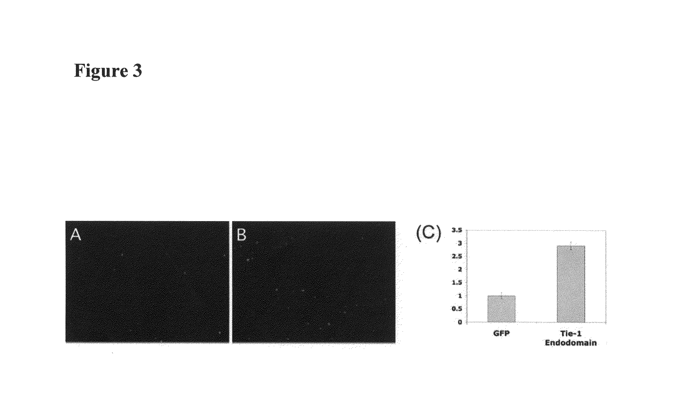 Methods and compositions for the treatment and diagnosis of vascular inflammatory disorders or endothelial cell disorders