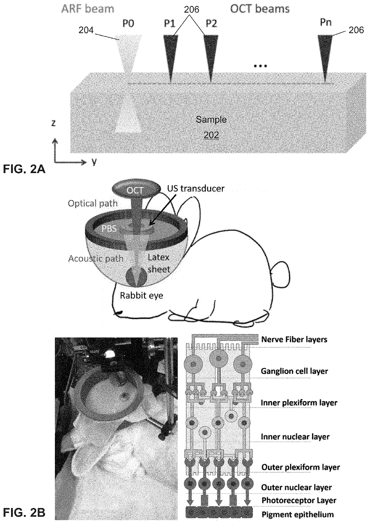 Shear wave based elasticity imaging using three-dimensional segmentation for ocular disease diagnosis