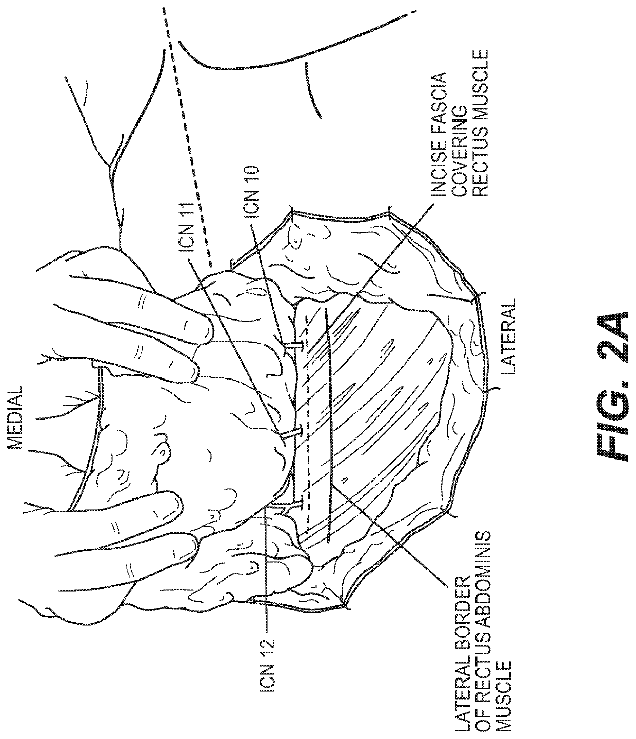 Materials and methods for nerve repair with animal-sourced grafts