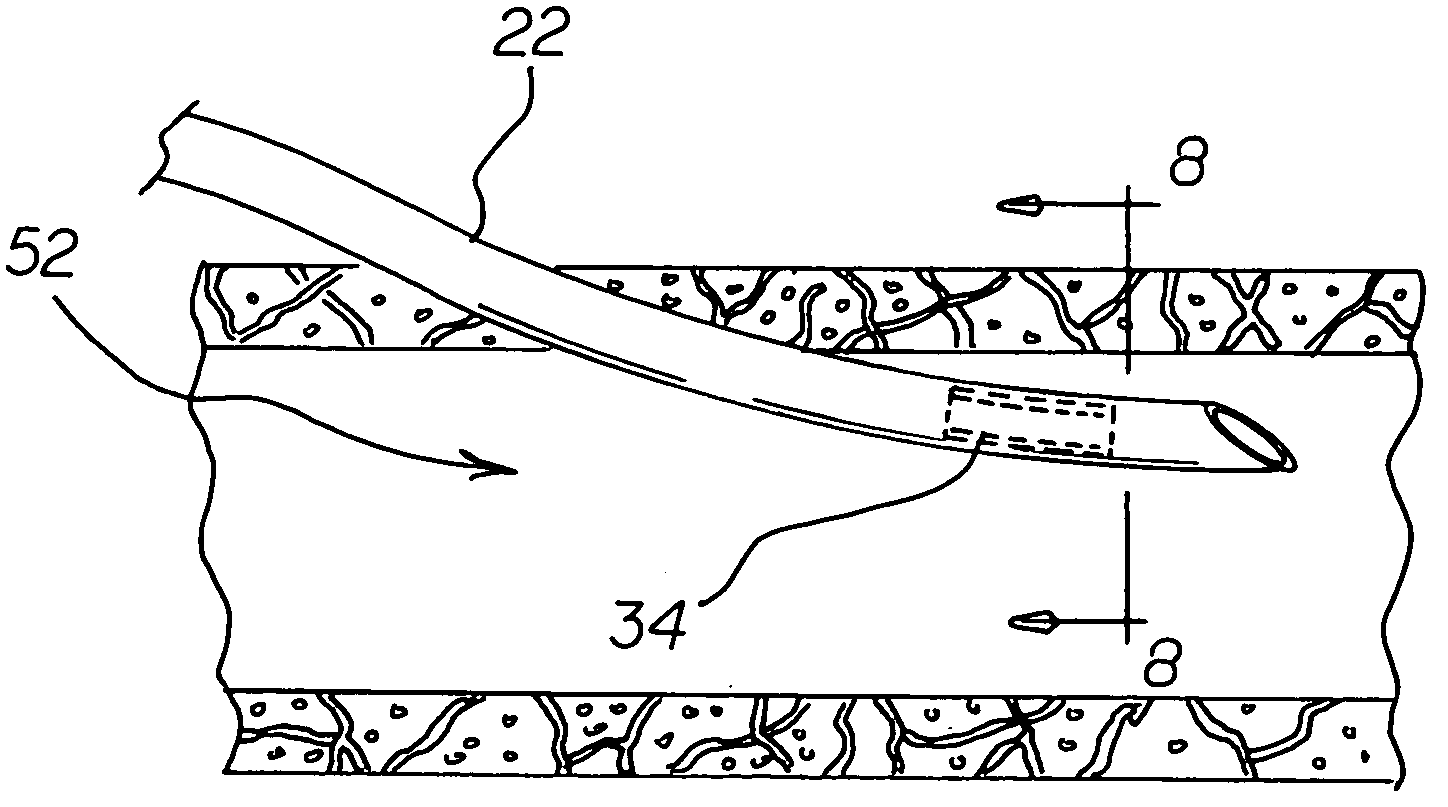 Portable microchip module for instantaneous analysis of bodily fluids