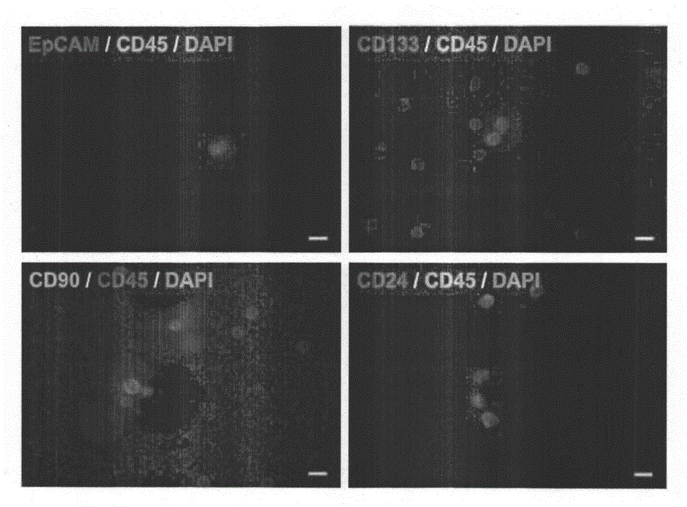 Circulating tumor stem cell detection kit based on magnetic beads and microfluidic chip