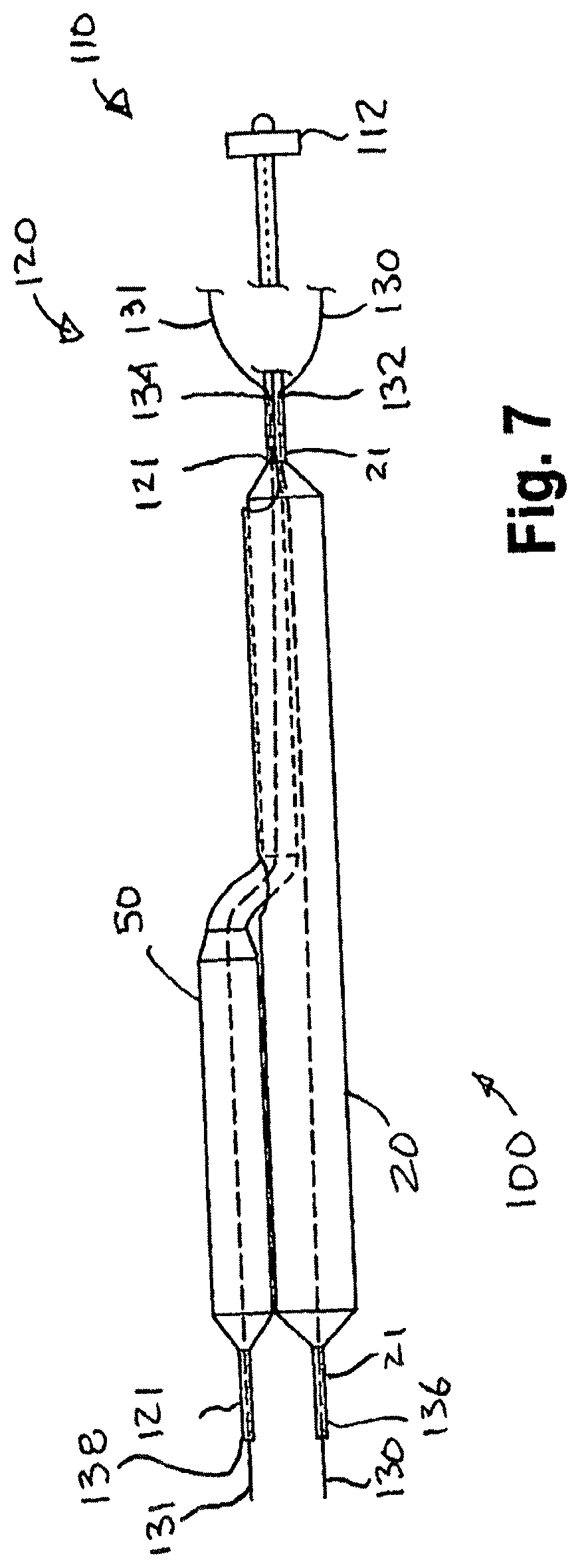 Bifurcated dual-balloon catheter system for bifurcated vessels