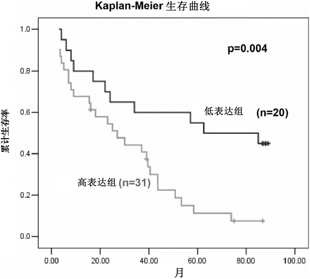 Application of SSX2IP in preventing and treating tumor metastasis