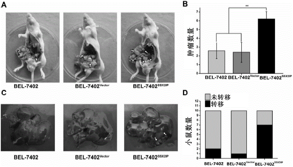 Application of SSX2IP in preventing and treating tumor metastasis