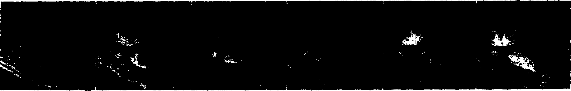 Medical sequence image motion estimation method based on generalized fuzzy gradient vector flow field